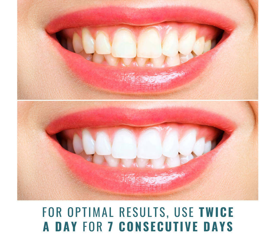 Dr. Dave's Express Precision Strips